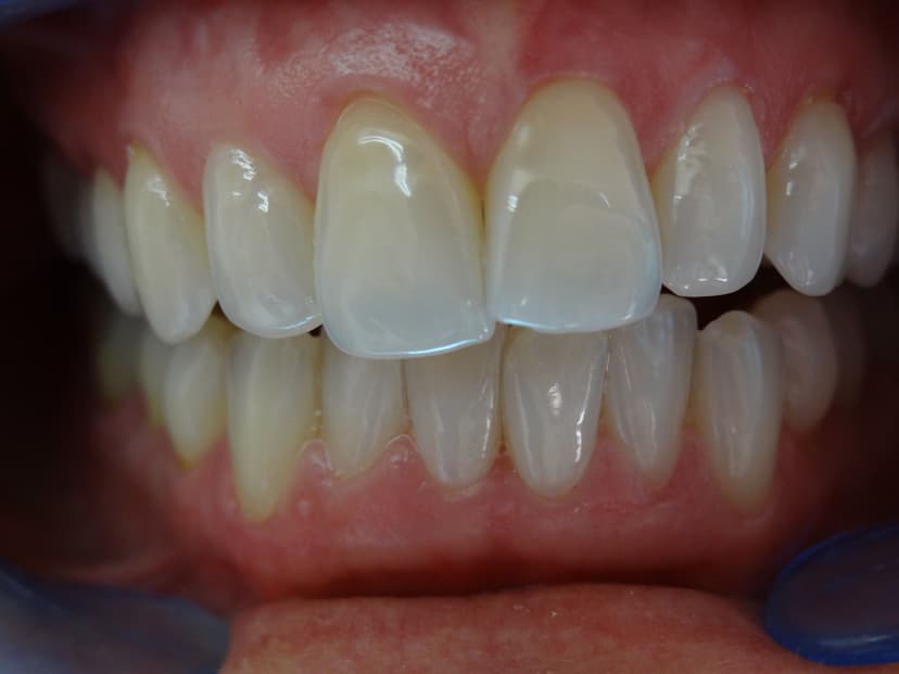 Ästhetische Zahnheilkunde